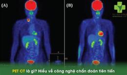 ảnh chụp màn hình dự đoán xổ số ct